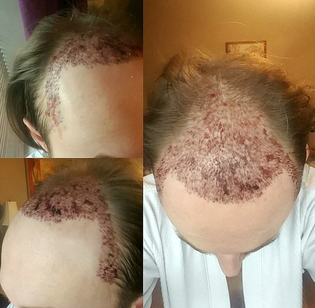 Новая шевелюра для лысого гея Новая шевелюра для лысого гея