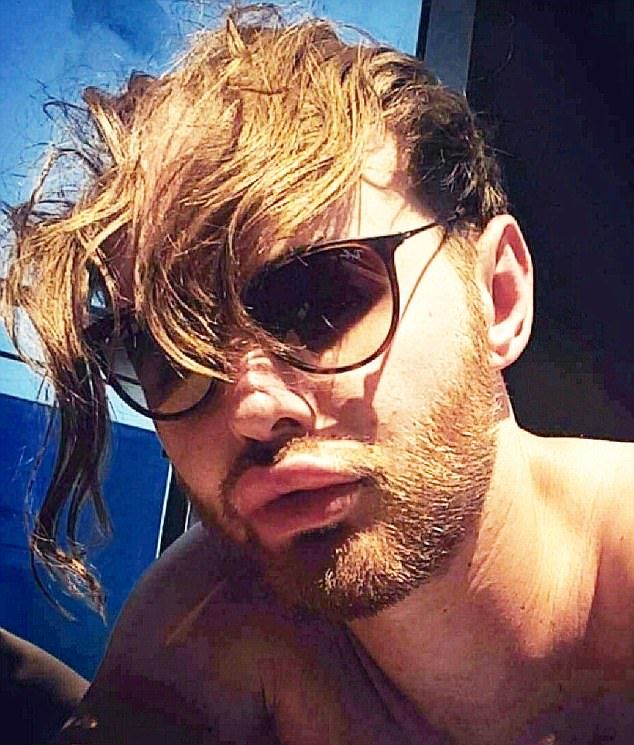 Новая шевелюра для лысого гея Новая шевелюра для лысого гея