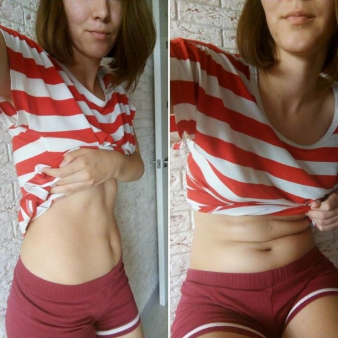 Российские девушки выкладывают свои животы в Инстаграм, призывая не стесняться своего тела