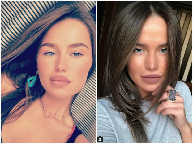 Звезды, которые стали непохожи на людей Звезды, которые стали непохожи на людей