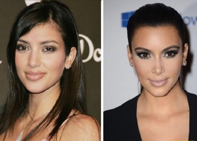 Как поменялась Ким Кардашьян со времен юности