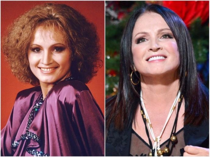 Пластический хирург рассказал, сколько стоит красота Софии Ротару, Лаймы Вайкуле и других российских певиц