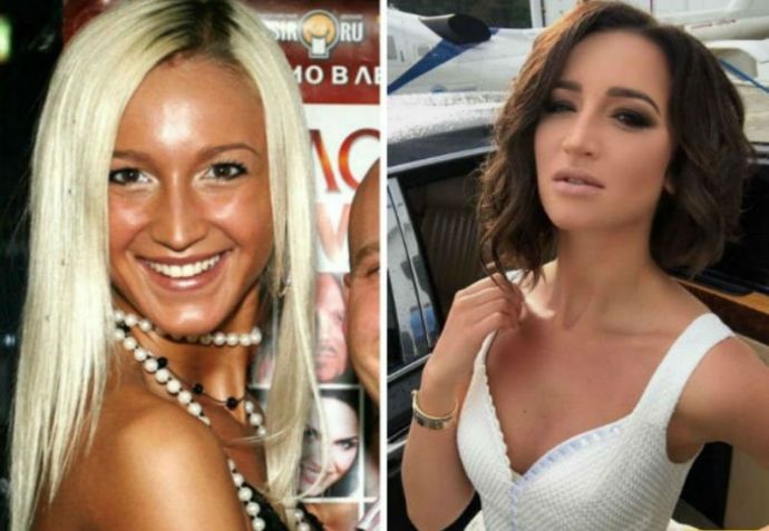 Сравнительные фото русских знаменитостей: до славы и сейчас