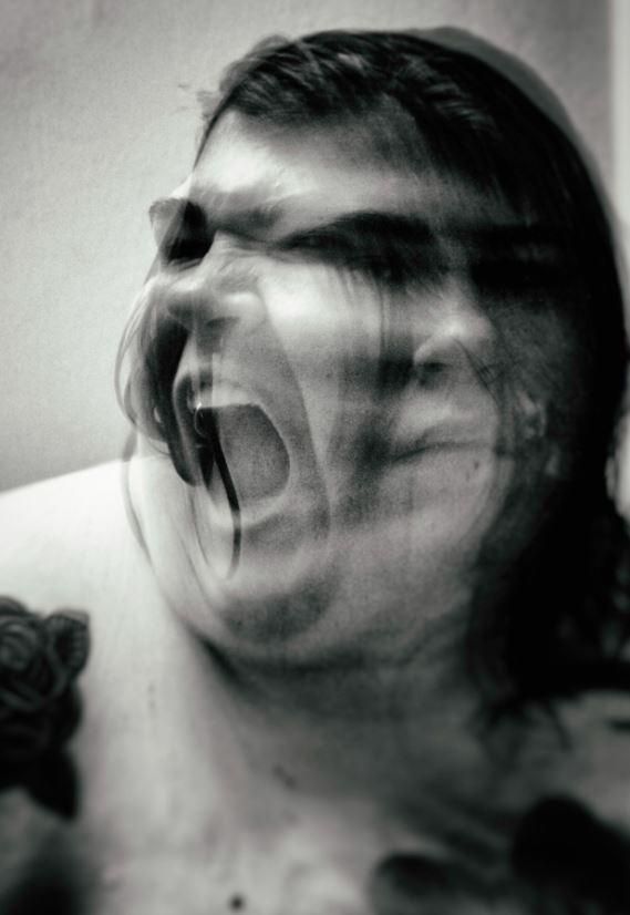 Откровенная фотосессия девушки, стремительно теряющей вес