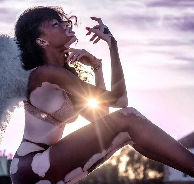 Модель с витилиго Винни Харлоу снялась в горячей фототосессии