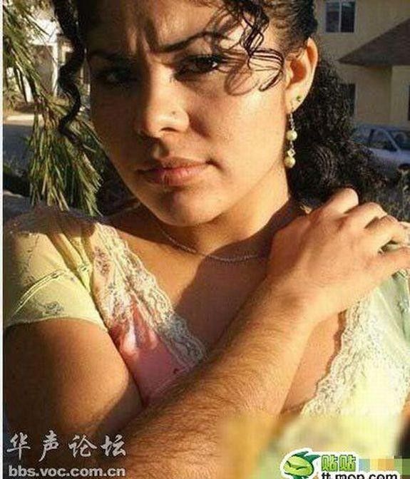 Волосатые руки у девушек