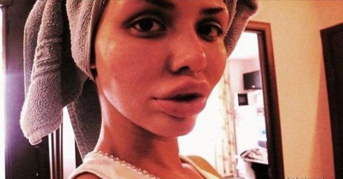 Еще одна жертва пластической хирургии