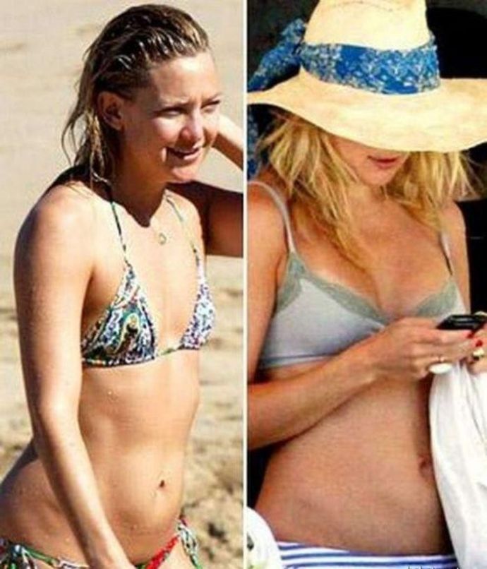 Звезды до и после силиконовых сисек