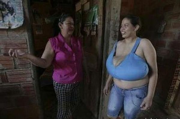 Грудь у тётки весит 9 килограммов