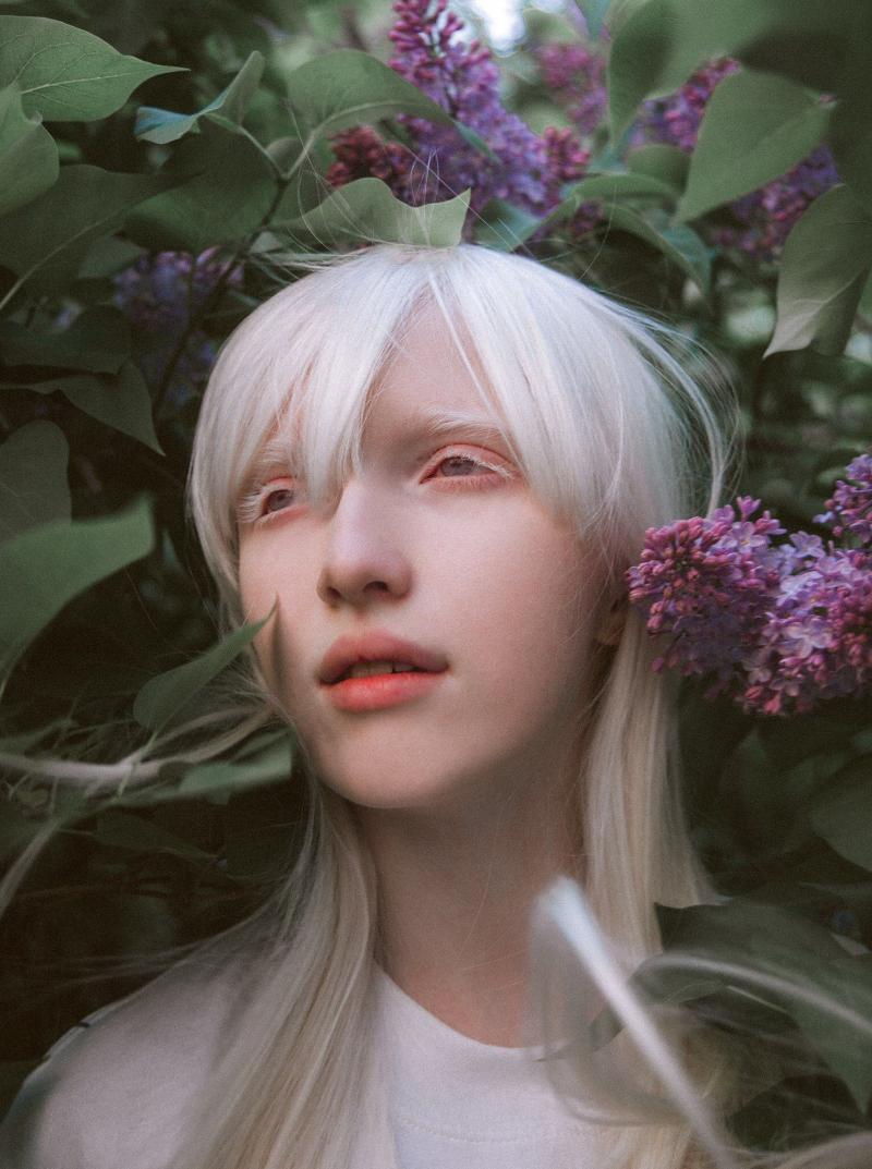 Әдемі альбинос қыз