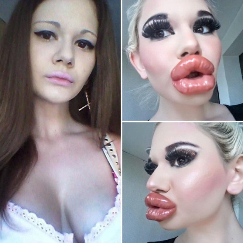 Дівчата з великими губами