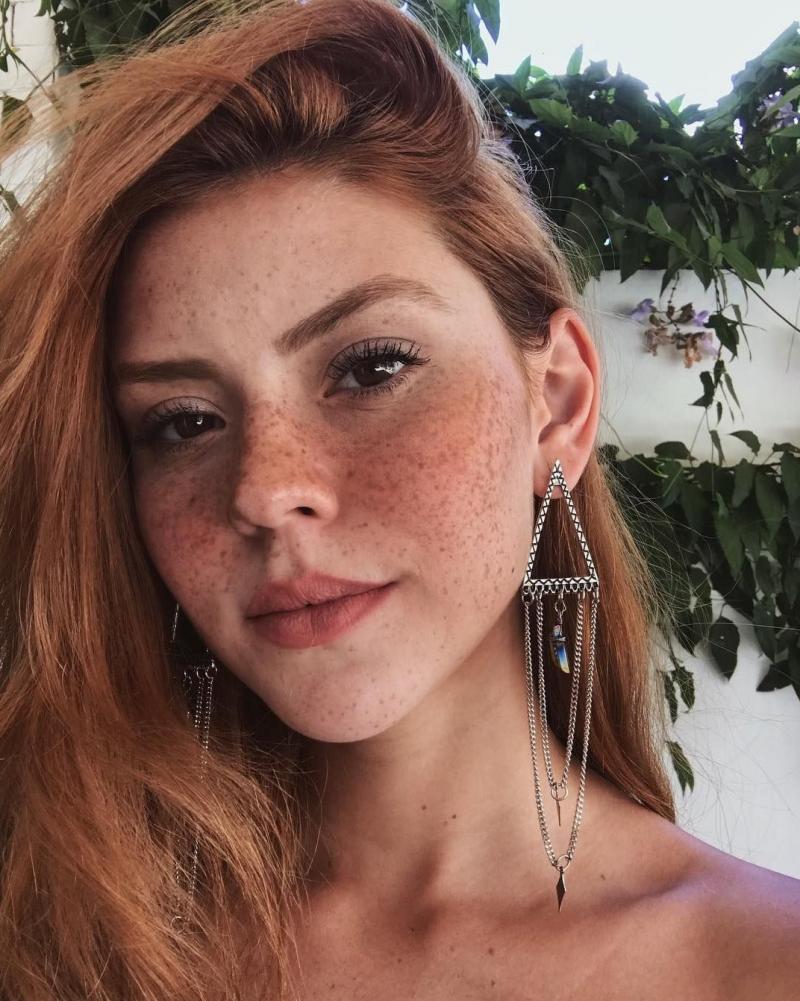 сепкілдері бар аққұба