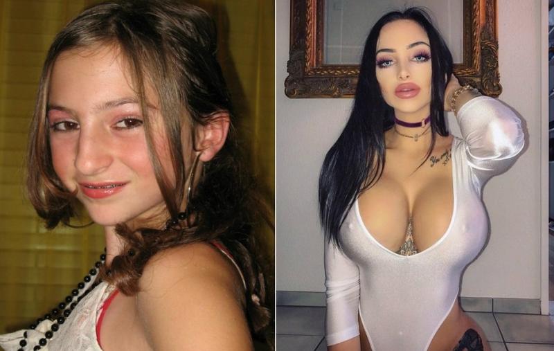 Фото: Над дівчиною знущалися через зовнішність, вона витратила $50 000 на пластику і її не впізнати