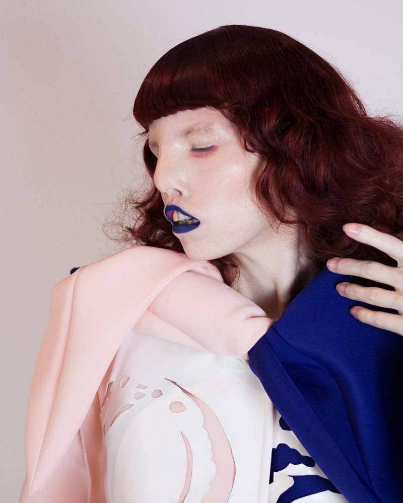 Фото: Модель с редким заболеванием побеждает гламур